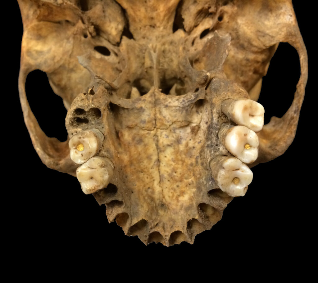 Person from the ossuary at San Ignacio with gold fillings in their teeth